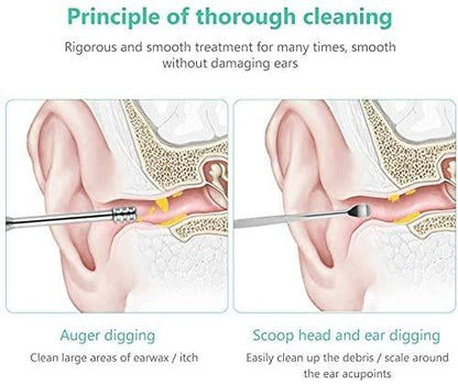 Ear Wax Removal Kit (6 Pcs)